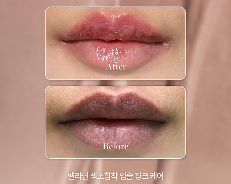 LINE_ALBUM_Lemella 照片_250608_6.jpg