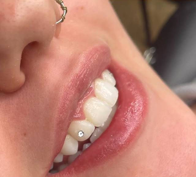Tooth Gem