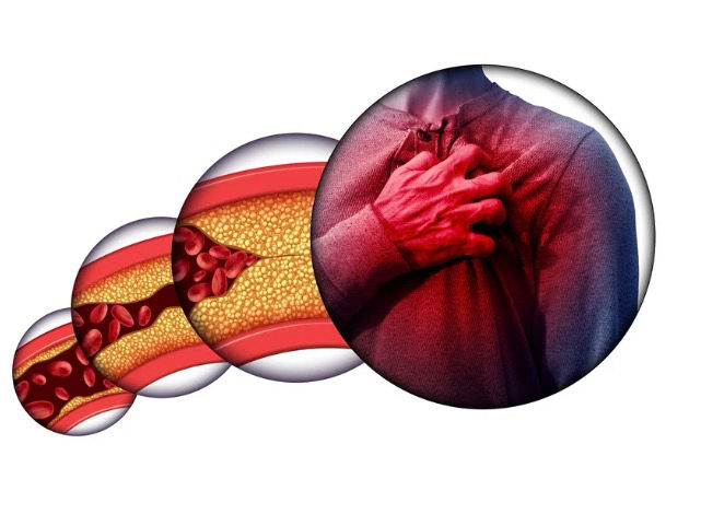 BTEC Applied Science Unit 1 Biology - The Science Behind Atherosclerosis