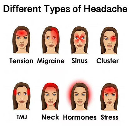Types of Migraines 1.jpg