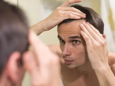 Inovação na saúde capilar: Limosilactobacillus fermentum no tratamento da alopecia androgenética.