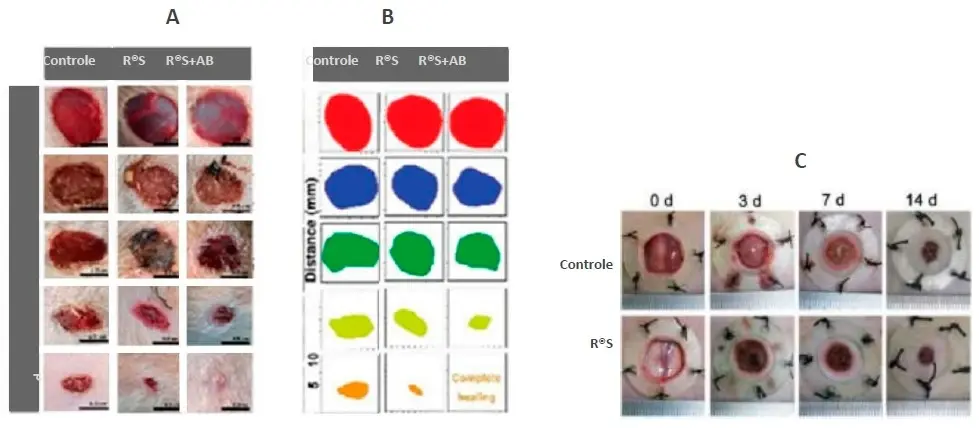     As imagens mostram a comparação entre o grupo controle, e cobaias tratadas com RECOL®SKIN, e aquelas tratadas com RECOL® SKIN + antibióticos (Imagens A e B). Na imagem C são apresentados os grupos controle e tratados com RECOL®SKIN. As imagens mostram a evolução das feridas ao longo dos dias, destacando a eficácia do tratamento com RECOL® SKIN na aceleração da cicatrização e qualidade do tecido formado. R®S (RECOL® SKIN); AB (antibiótico).
