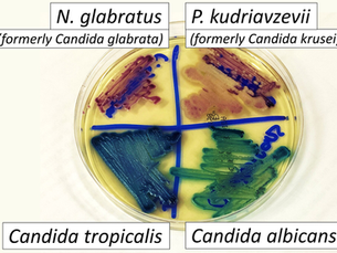 Machine Learning & Metabolism - Undergraduate project by Tanusree Chepuri