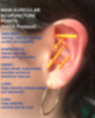 Acupuncture NADA Protocol .jpeg