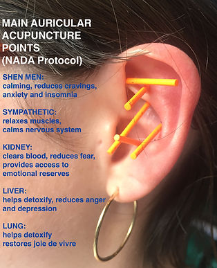 Acupuncture NADA Protocol .jpeg