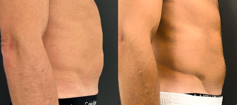 Strengthen, tone, and firm the abdomen, thighs, buttocks, and arms