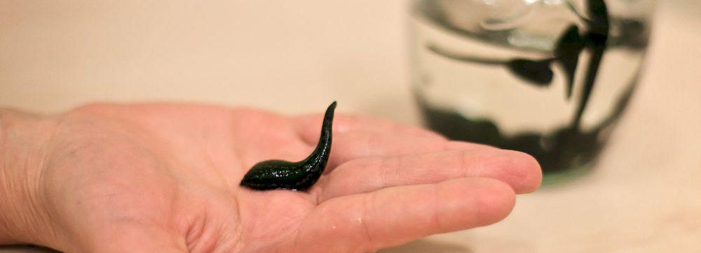 Гирудотерапия