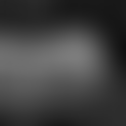 En quoi consiste la césarienne ?