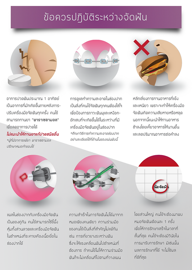 ข้อควรปฏิบัติระหว่างจัดฟัน บ้านหมอฟัน