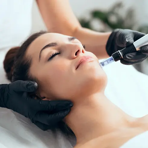 what-is-microneedling.webp