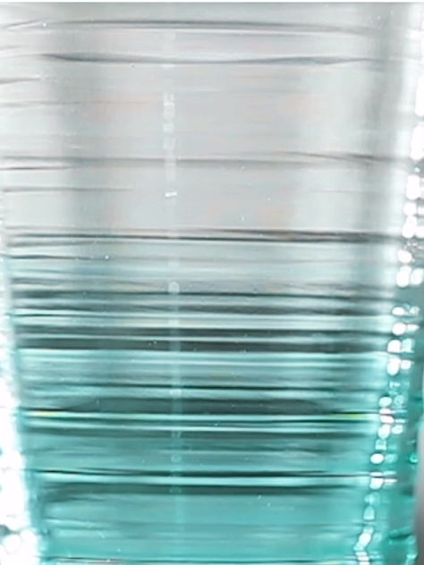 Understanding Dehydration: Symptoms, Causes, Effects, and Treatment