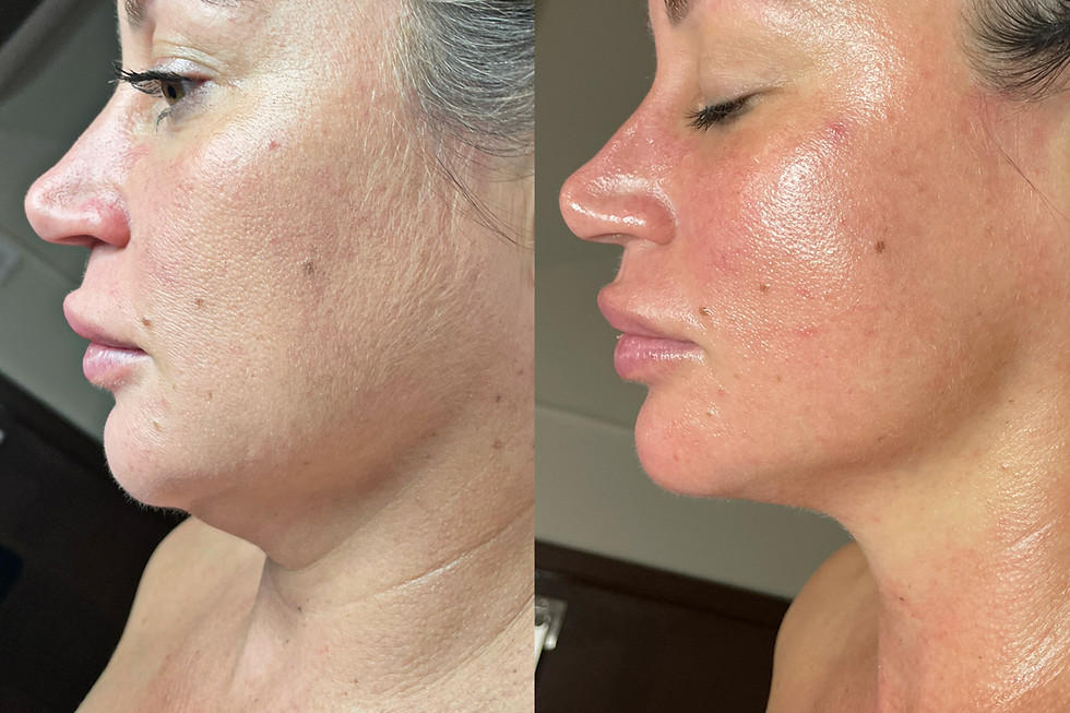 results by skin x chelsea with vanity technologies