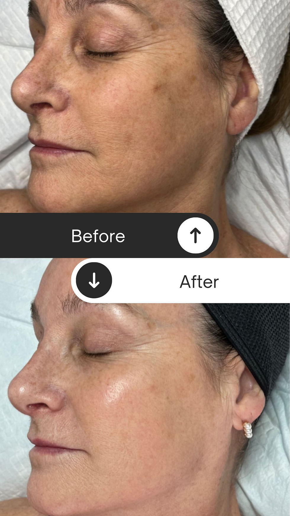 results by skin x chelsea with vanity technologies