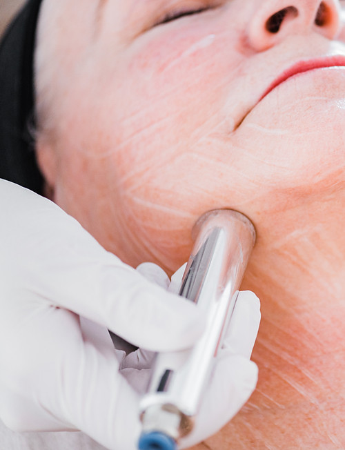 results by skin x chelsea with vanity technologies