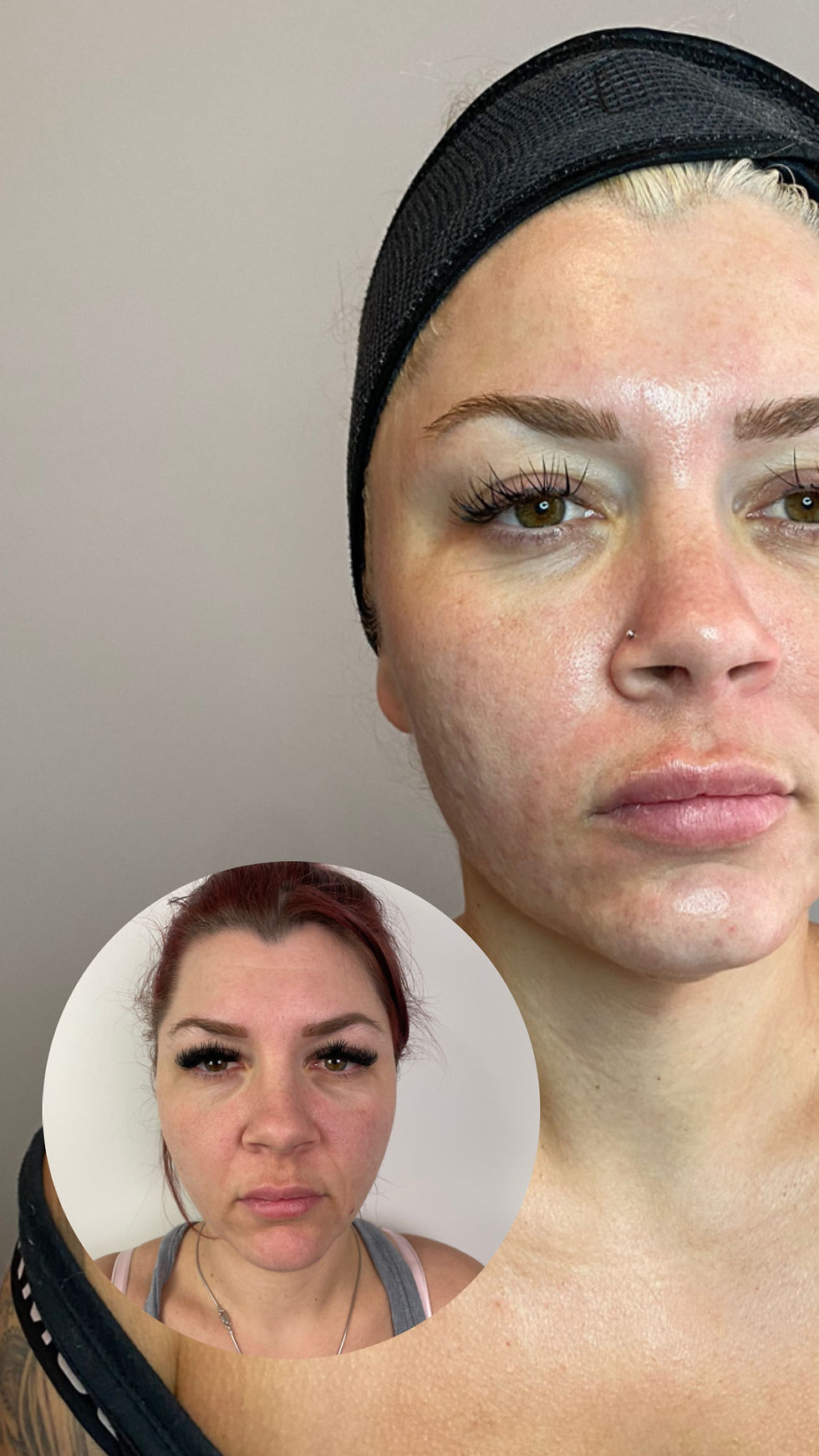 results by skin x chelsea with vanity technologies