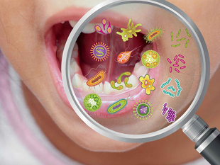 The Oral Microbiome and Cancer: How Are They Related?(Post #14)