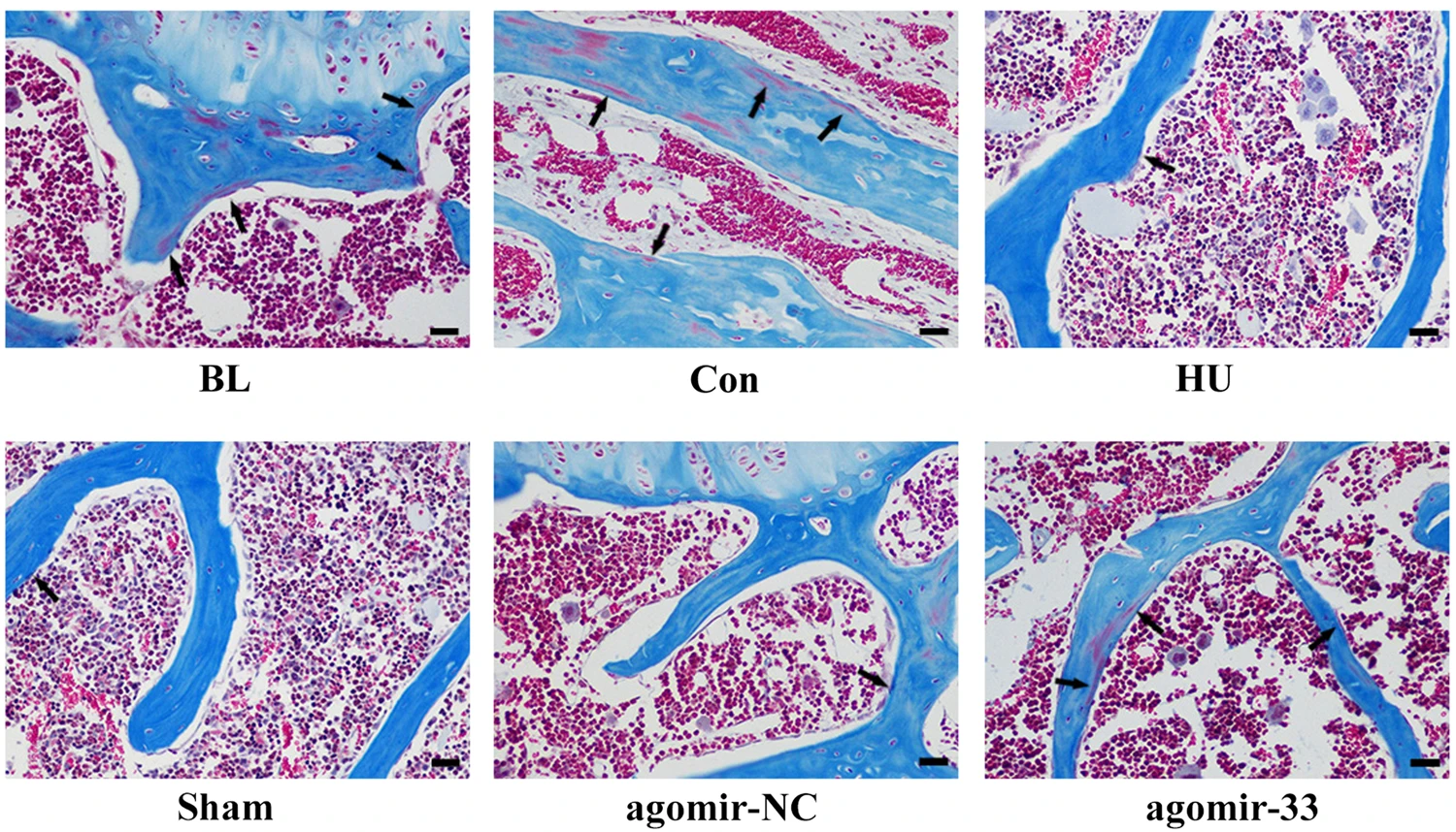 Osteoblast-targeted delivery of miR-33-5p attenuates osteopenia development induced by mechanical unloading in mice
