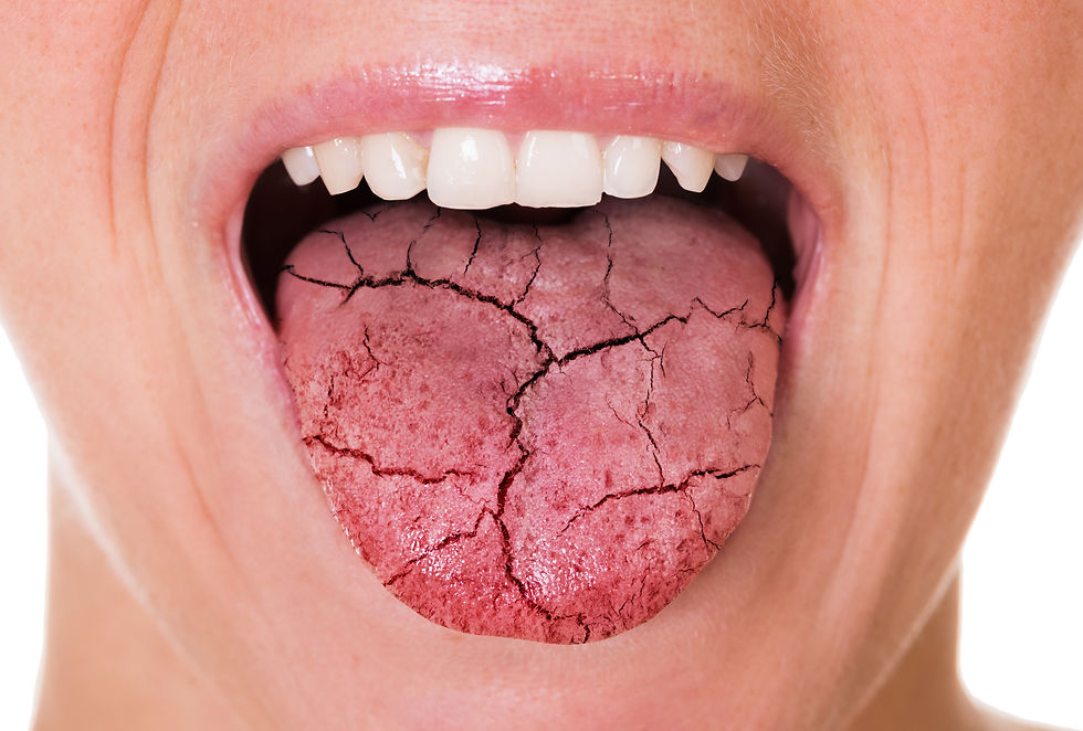 Dry mouth from using Ozempic