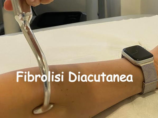 Fibrolisi Diacutanea: Una Guida Semplice per Pazienti