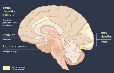 Pathologies du sommeil, médecine, pitié salpêtrière, illustration médicale