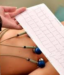 ekg.jpeg