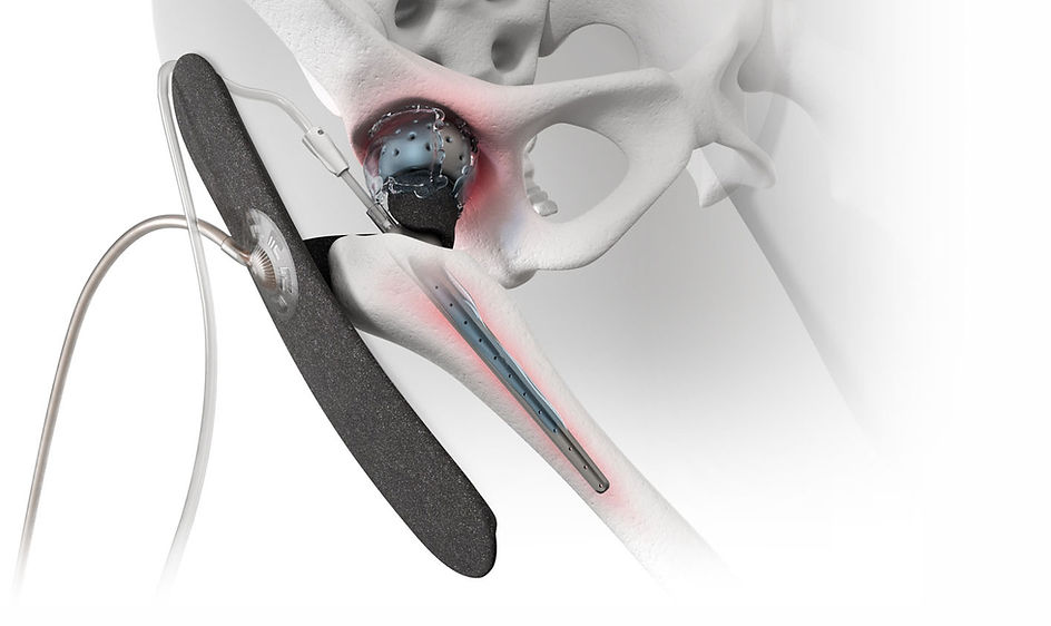 VT-X7 treatment graphic2.jpg