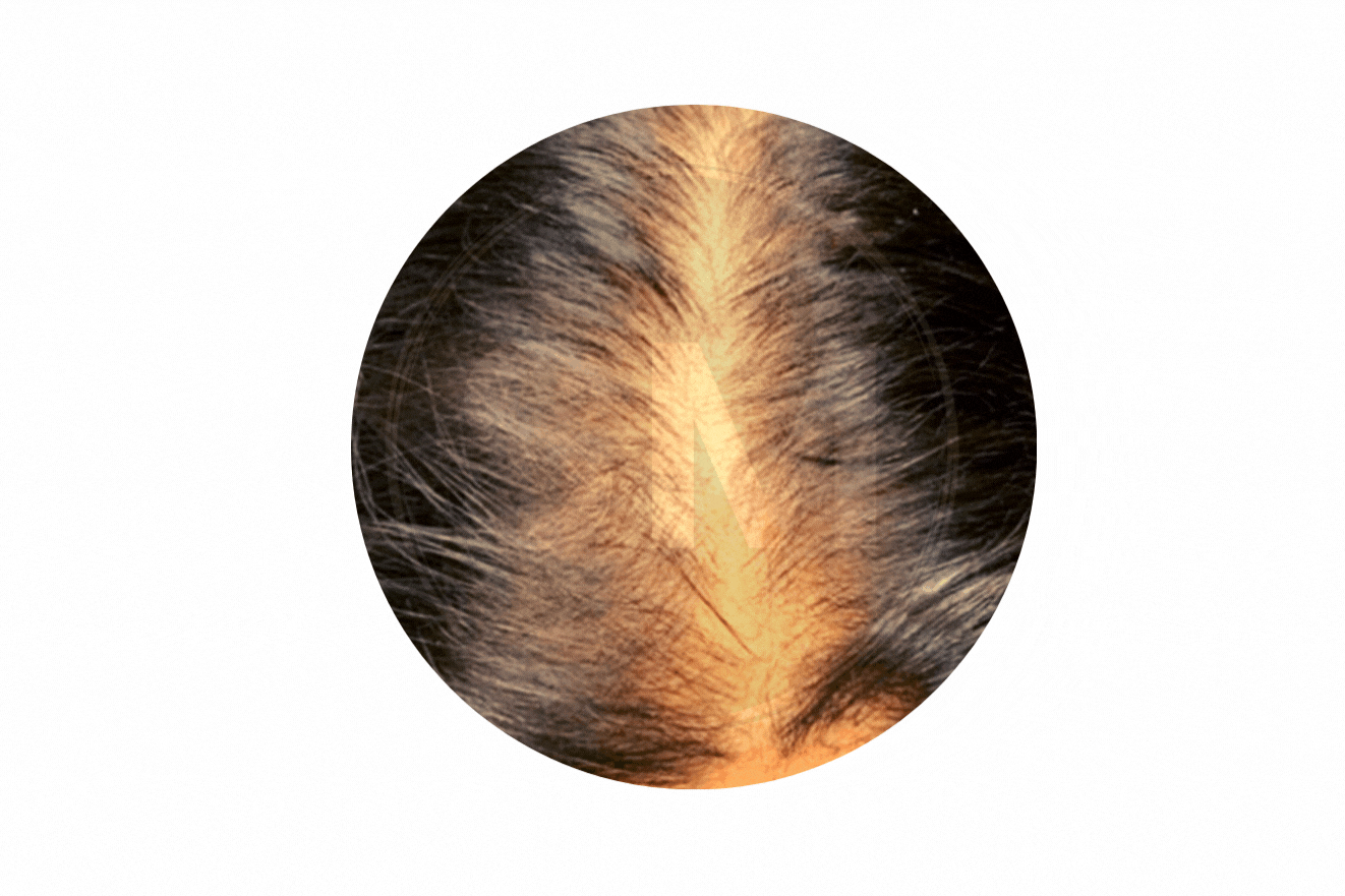 SkinMinds Hair Gif Female (4).gif