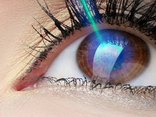 Lentes de contato ou cirurgia refrativa?