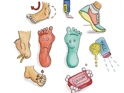 Sportif·ves, prenez soin de vos pieds