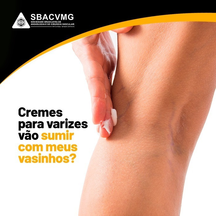 Creme para Varizes não funcionam