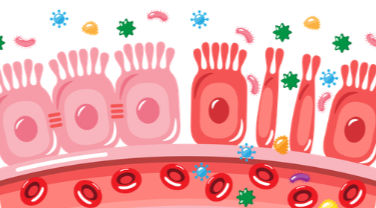 Dysbiose image