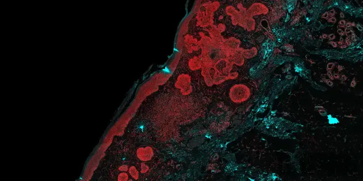 illumiSonics Featured in BioTuesdays: Expanding the Limits of Tissue Imaging with a Single Scan