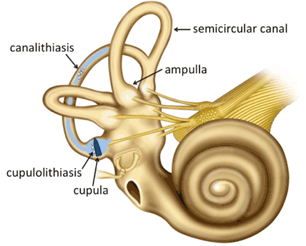 physical therapy, dizziness, BPPV, vertigo