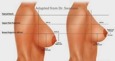 breastsurgery_0201.jpg