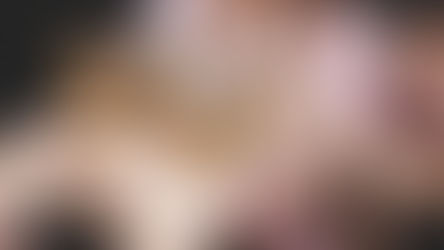 術後嗨過頭！紅腫熱痛毀年假　鄭明輝院長點名「修復期4大地雷」