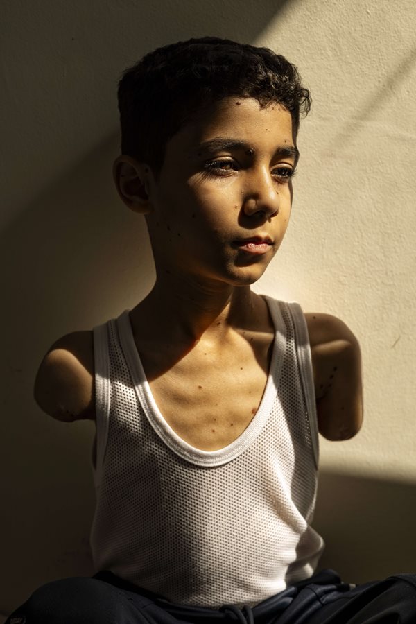 Exposición World Press Photo 2025 se inaugura en el Museo Franz Mayer