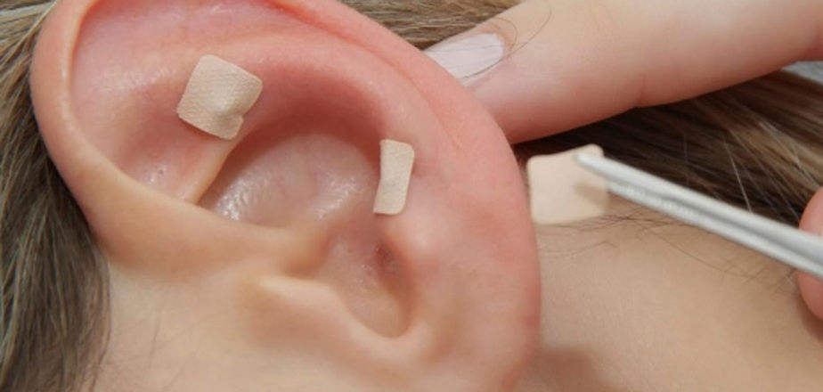AURICULOTERAPIA.jpg