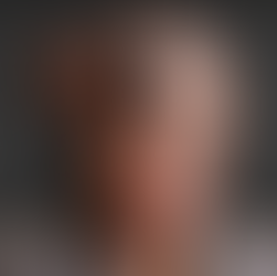 Cuidados domiciliarios especializados para personas con Alzheimer