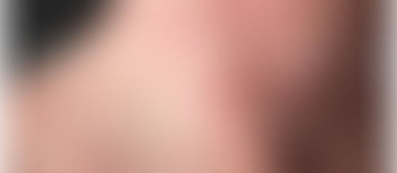 【有關濕疹的事,是你和我的事】