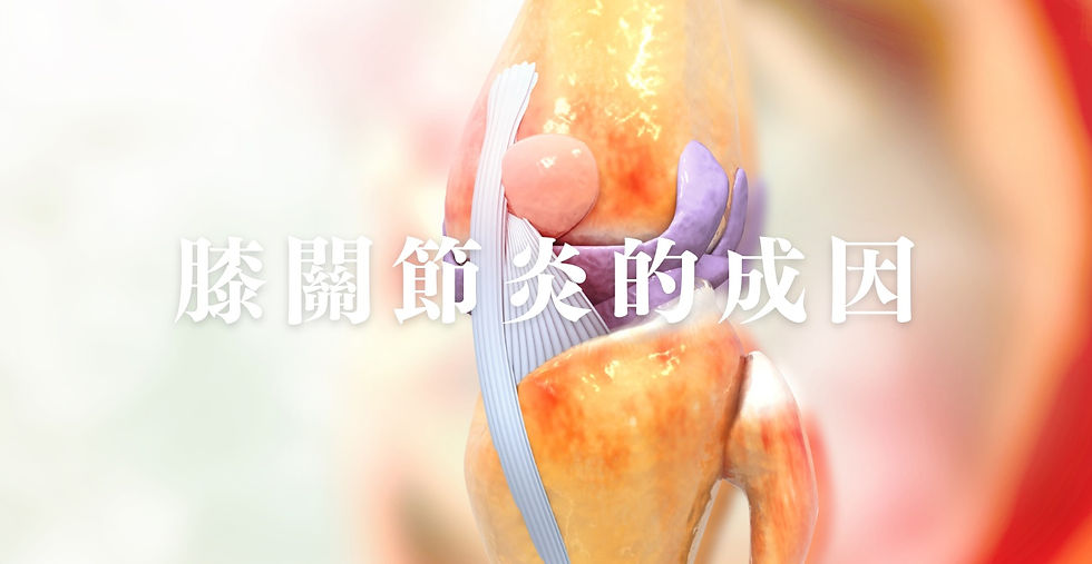 膝關節炎的成因