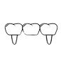 dental bridge