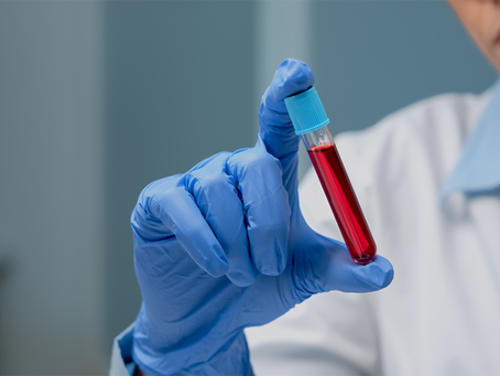 5 passos para evitar hematomas após a coleta de sangue