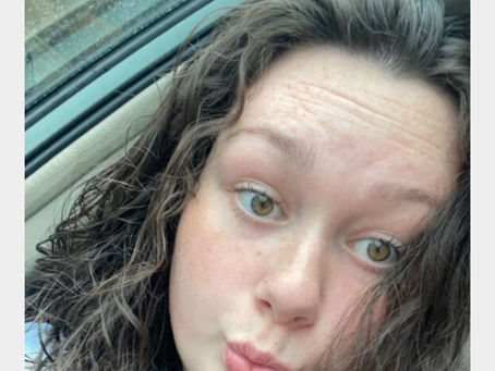 Alana-Organ Donation