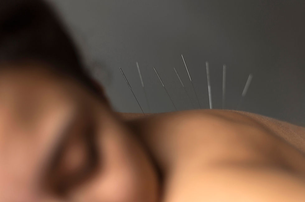 close-up-patient-acupuncture-procedure.jpg