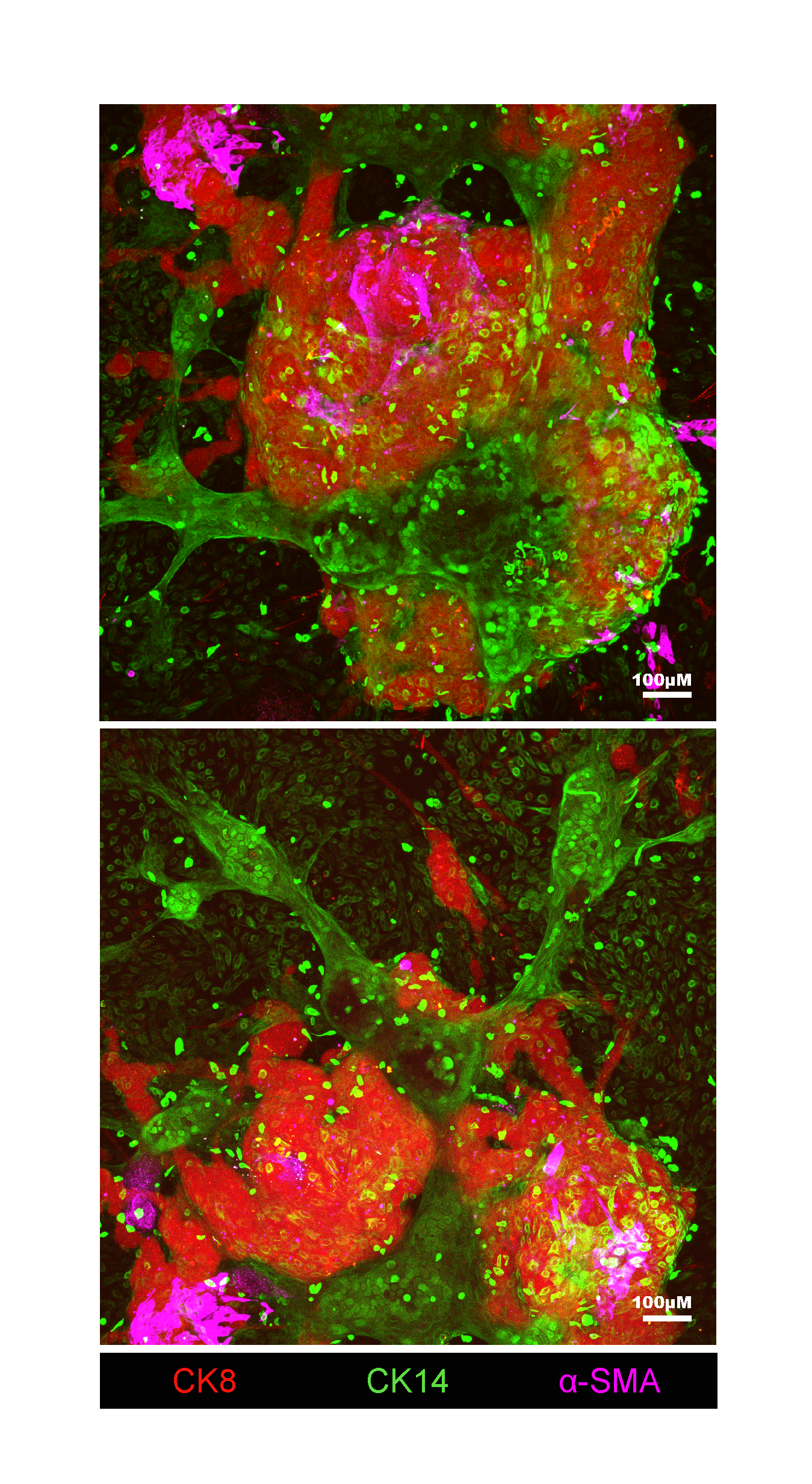 Patient-derived organoids