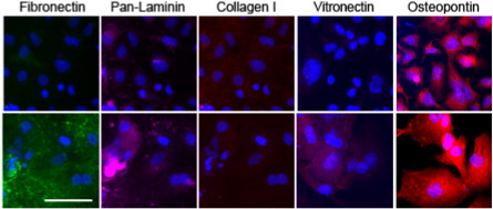ECM and Breast Cancer Dormancy
