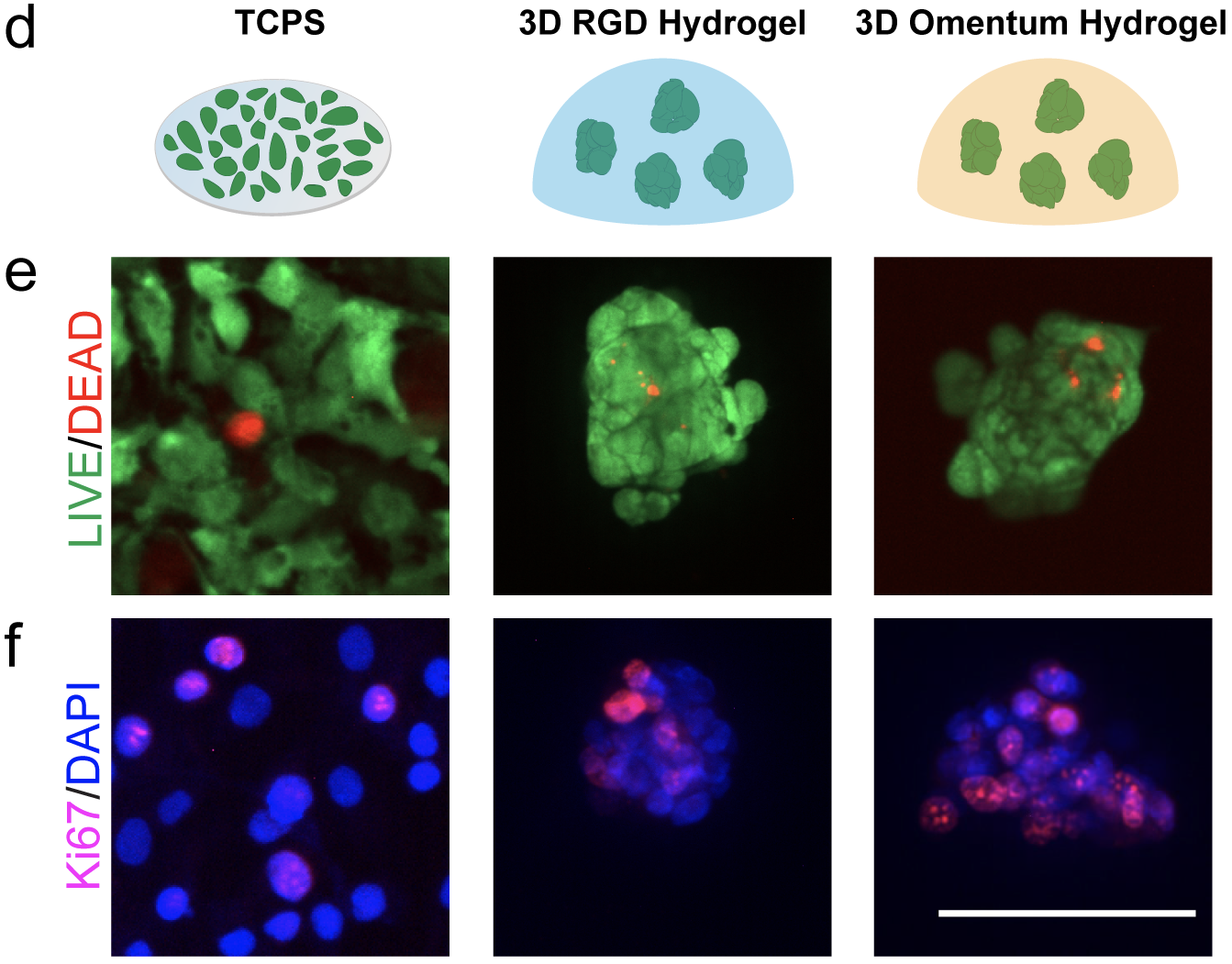 Drug Screening Tumor Spheroids