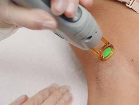 Client relaxing during Brazilian laser hair removal with the Candela GentleMax Pro at Hello Laser in Scottsdale