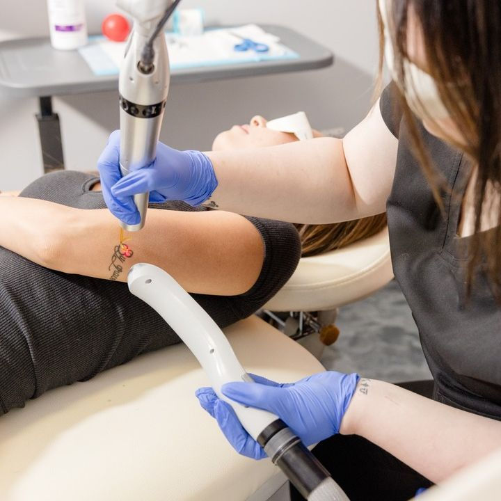 Hello Laser in Arcadia Biltmore offers laser tattoo removal.