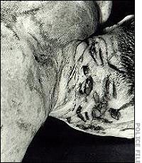 Victim of William MacDonald
